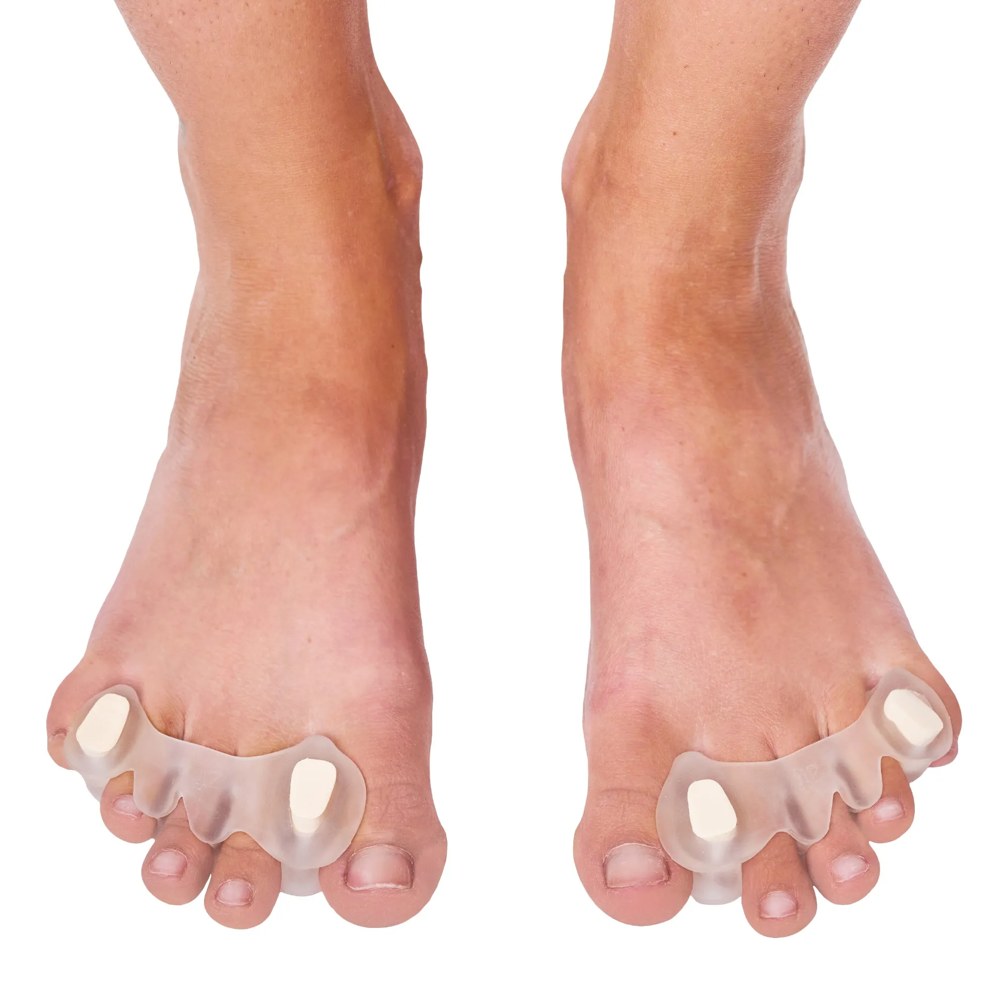 Customizable Toe Separators with Inserts